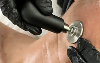 Indiba en Valencia: El tratamiento que conecta belleza, bienestar y confianza femenina